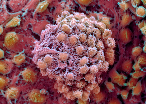 Эмбриональные стволовые клетки. (Фото Stem MD / Flickr.com.)