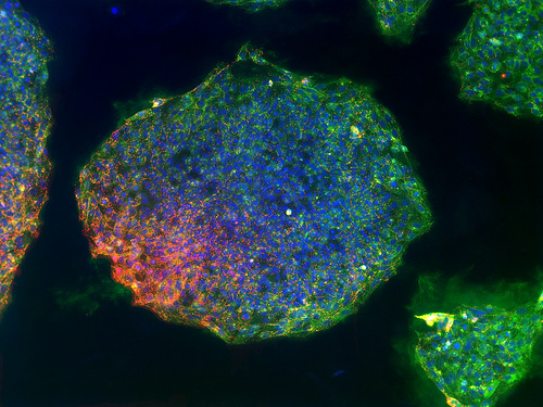 Индуцированные стволовые клетки, полученные из клеток кои человека. (Фото Science 3.0 / www.flickr.com/photos/scientificrelevance/4206507558.)
