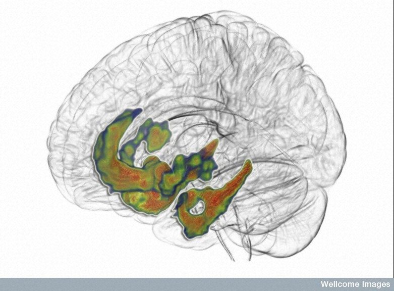 Распределение нейромедиатора гамма-аминомасляной кислоты в лимбической системе мозга, сфотографированное с помощью позитронно-эмиссионного томографа. (Фото Wellcome Images / www.flickr.com/photos/wellcomeimages/16559035167/.)