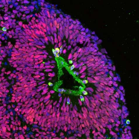 Разрез кортикального сфероида, полученного при 3D-культивировании индуцированных стволовых клеток человека; красным окрашены созревшие нервные клетки, зелёным – делящиеся стволовые предшественники. (Фото The Pasca Lab.)