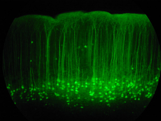 Нейроны соматосенсорной коры мыши; тела клеток находятся в пятом слое коры, их отростки доходят до её поверхности. (Фото Robert Cudmore / Flickr.com.)