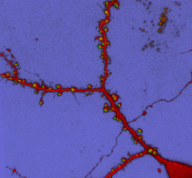Нейронные отростки, покрытые дендритными шипиками. (The Journal of Cell Biology / Flickr.com.)