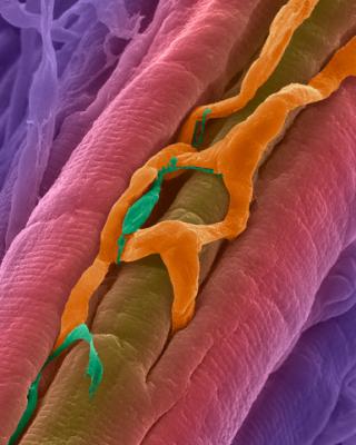 Волокна сердечной мышцы с капилляром и возбудительным волокном Пуркинье, передающим сократительный сигнал. (Фото Dennis Kunkel Microscopy, Inc. / Visuals Unlimited / Corbis.)