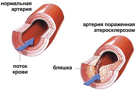 передача все буде добре злаковая диета