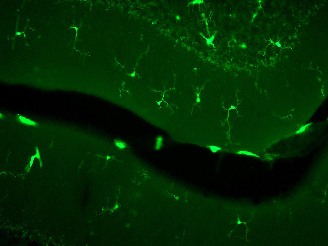 Клетки микроглии (зеленые) в мозжечке мыши. (Фото: soniclove2100 / Flickr.com)