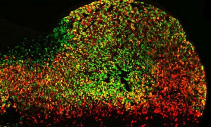 Активность двух дублирующих друг друга энхансеров в клетках мыши: в зеленых работает один, в красных – второй, в желтых – оба сразу. (Фото: Marco Osterwalder / Lawrence Berkeley National Laboratory)