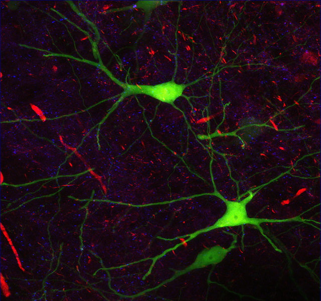 Нейроны мозга мыши. (Фото ZEISS Microscopy / Flickr.com.)