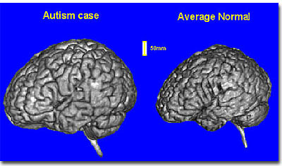   -  ,    . (: Steve Emfield / Flickr.com.) 