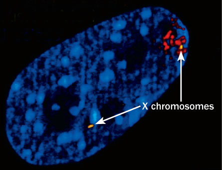 Участки двух хромосом окрашены жёлтым, при этом одна из них активна, другая же находится в комплексе с Xist-РНК (окрашена красным) и неактивна. (Фото GENECLEANER / WIKIMEDIA.)