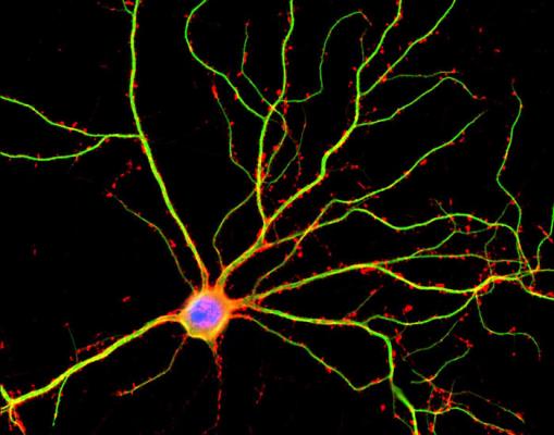 Один из нейронов мозга: зеленым окрашены отростки-дендриты, красные точки – дендритные шипики, места потенциальных межнейронных контактов. (Фото: Shelley Halpain / UC San Diego)