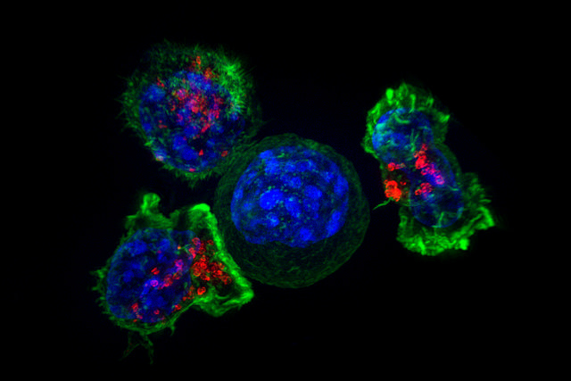 Три Т-лимфоцита, окружившие раковую клетку. (Фото NICHD / Flickr.com.) 