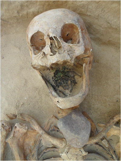 Женщину 45-49 лет погребли с камнем на шее. Фото: PLoS ONE.  
