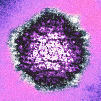 Вирус герпеса под электронным микроскопом. (Фото: AJC1 / Flickr.com)