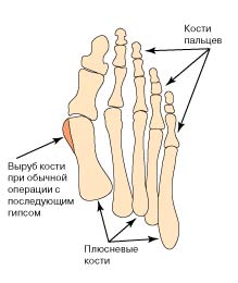 Рожа на ноге лечение народными средствами красной тряпкой