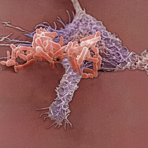 Макрофаг, поедающий бактерий. (Фото Dr. David Phillips / Visuals Unlimited / Corbis.)