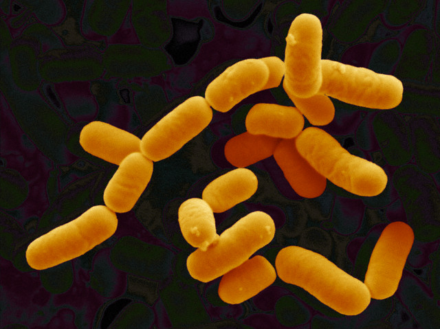 Бактерии Lactobacillus rhamnosus – одни из полезных симбионтов пищеварительной системы человека и животных, подавляющие рост своих патогенных «коллег». (Фото Visuals Unlimited / Corbis.)