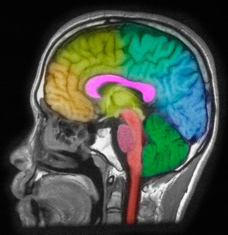 МРТ-снимок, позволяющий увидеть различные отделы мозга. (Фото Callista Images / cultura / Corbis.)