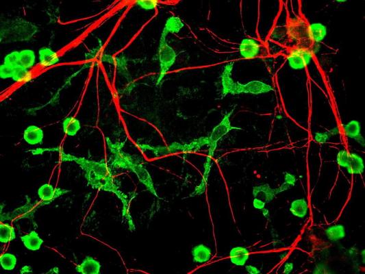 Клетки микроглии (зеленым) и нервные волокна (красным). (Фото: GerryShaw / Wikipedia)&nbsp;