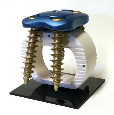 Модель позвоночного имплантата. (Фото: KiwiMill Model Makers / Flickr.com)&nbsp;