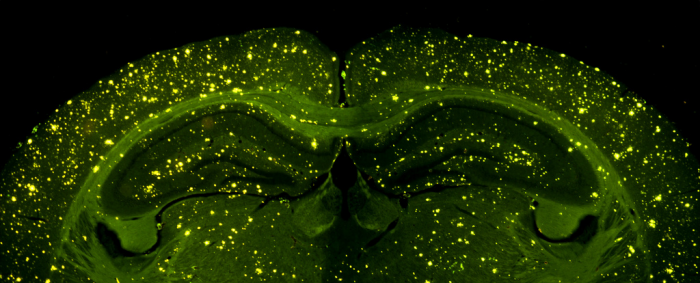 Отложения альцгеймерических белков в мозге мыши. (Фото Enrique T / Flickr.com)