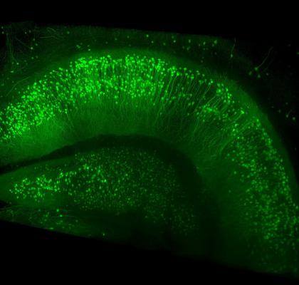 Срез через гиппокамп мыши. (Фото: ZEISS Microscopy / Flickr.com)&nbsp;