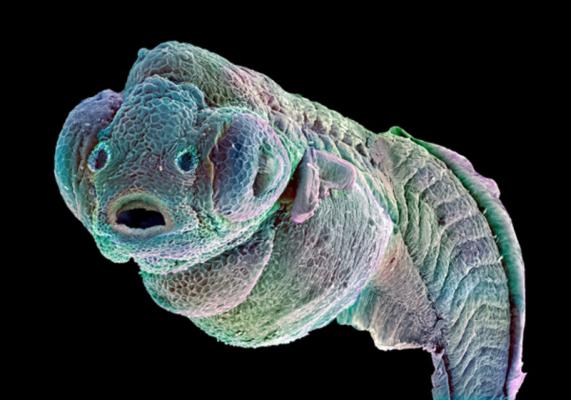 Зародыш рыбы Danio rerio. (Фото: Annie Cavanagh / Wellcome Collection)