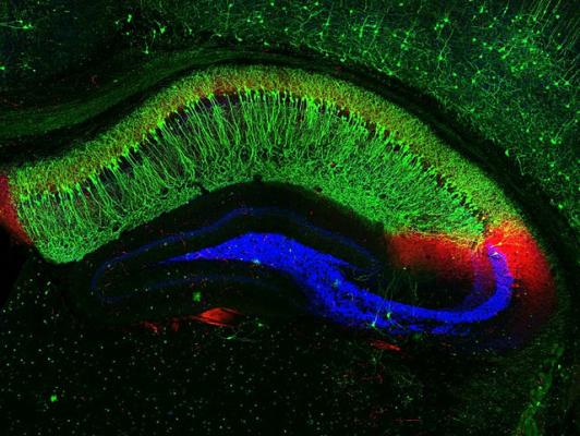 Срез через гиппокамп мыши; нейроны зоны CA1 окрашены зеленым, нейроны CA3 – синим. (Фото: NIH Image Gallery / Flickr.com)&nbsp;