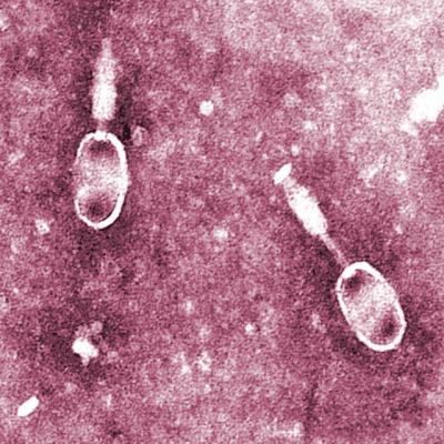 Бактериофаги под электронным микроскопом. (Фото: microbiologybytes / Flickr.com)&nbsp;