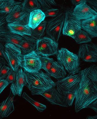 Клетки сердца, выращенные из стволовых клеток. (Фото: British Heart Foundation / Flickr.com)&nbsp;