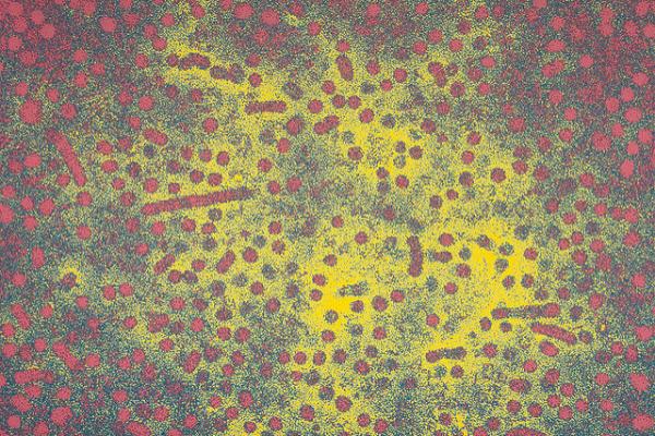 Частицы вируса гепатита В под электронным микроскопом. (Фото: Sanofi Pasteur / Flickr.com)&nbsp;