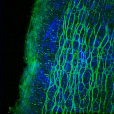 Волокна коллагена (синие) и эластина (зеленые) в стенке артерии. (Фото: University of Exeter / Flickr.com) 