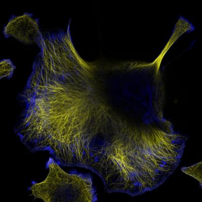 Система микротрубочек в клетке (окрашены желтым), другой элементы цитоскелета, актиновые нити, окрашены синим. (Фото: mohsin ahmad / Flickr.com)&nbsp;