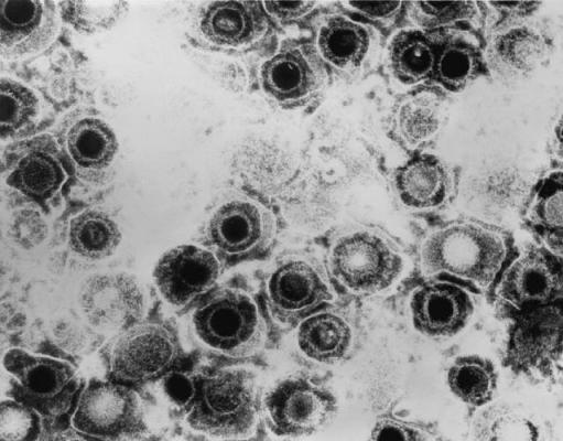 Частицы вируса герпеса под электронным микроскопом. (Фото: Dr. Erskine Palmer / Wiklipedia)&nbsp;