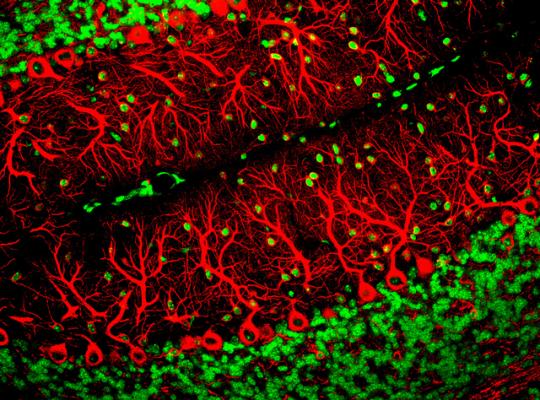 Клетки Пуркинье (окрашены красным) в срезе мозжечка. (Фото: ZEISS Microscopy / Flickr.com)&nbsp;