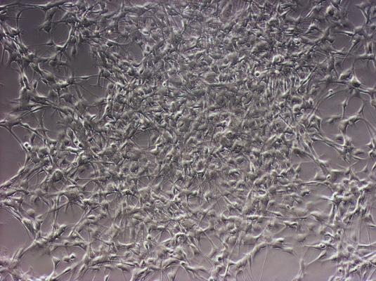 Нервные стволовые клетки человека. (Фото: thezygo / Flickr.com)&nbsp;