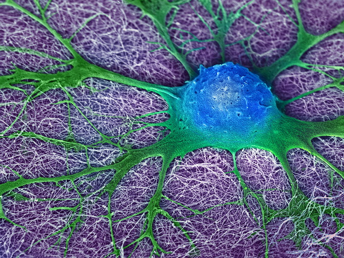Стволовые клетки используют против рассеянного склероза