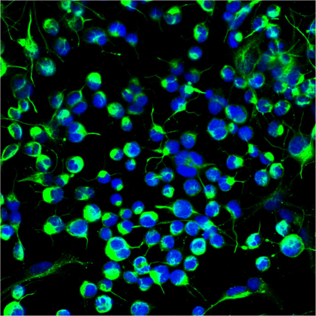 Нервные стволовые клетки взрослого мозга. (Фото: California Institute for Regenerative Medicine / Flickr.com.)