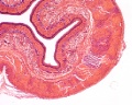 Esophagus SEC (1)