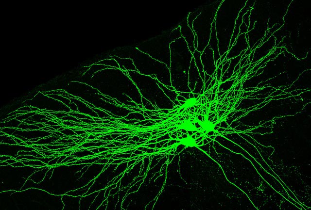      . (: Kavli Institute for Systems Neuroscience NTNU / Flickr.com)