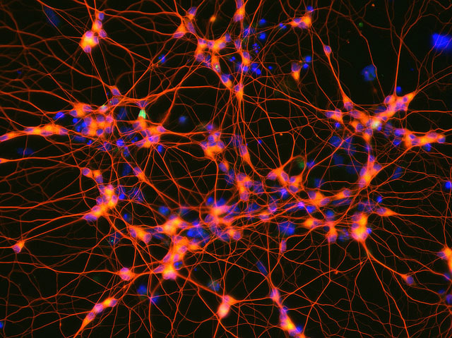 Моторные (двигательные) нейроны, выращенные из эмбриональных клеток мыши. (Фото: Penn State / Flickr.com.)