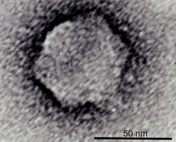 Фаг vB_AbaP_AS11 под электронным микроскопом. (Фото: Anastasia V. Popova et al., / Viruses 2017, 9(7), 188.)