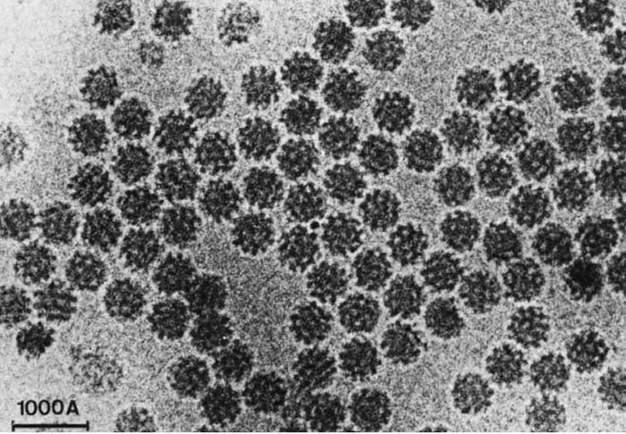 Вирусные частицы в остеклованной воде – первое изображение, полученное Дюбоше в 1984 г. (Иллюстрация: Nobelprize.org.)