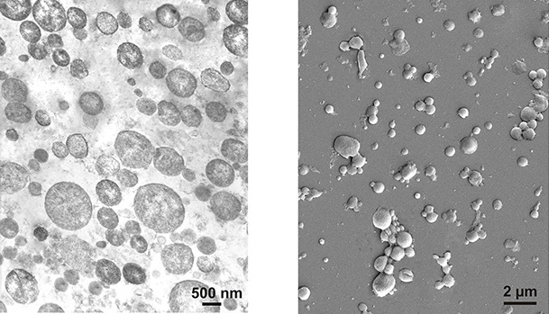 Пузырьки-везикулы, сформированные клетками нейробластомы: слева – изображение с электронного микроскопа, справа – со сканирующего электронного микроскопа. (Фото: Marina O. Gomzikova et al., Oncotarget, 2017.)