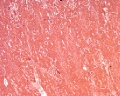 Kidney Sec (1)