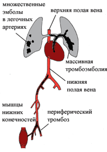 ОПАСНОСТЬ, КОТОРУЮ МОЖНО ПРЕДОТВРАТИТЬ