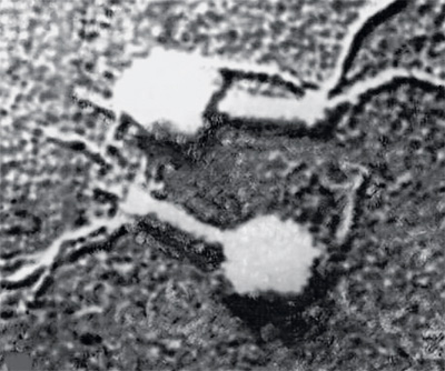 Бактериофаги: убийцы в роли спасителей