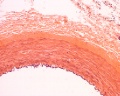 Arteriovenous C S (1)