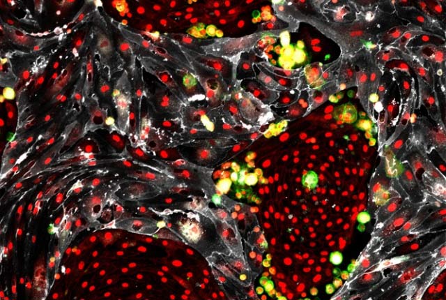 Клетки сосудов (зеленые), превращенные экспресс-методом в кроветворные клетки. Серым окрашены клетки-няньки, помогающие клеткам сосудов стать кроветворными. (Фото: Dr. Raphael Lis / Tri-Institutional Stem Cell Derivation Laboratory.)