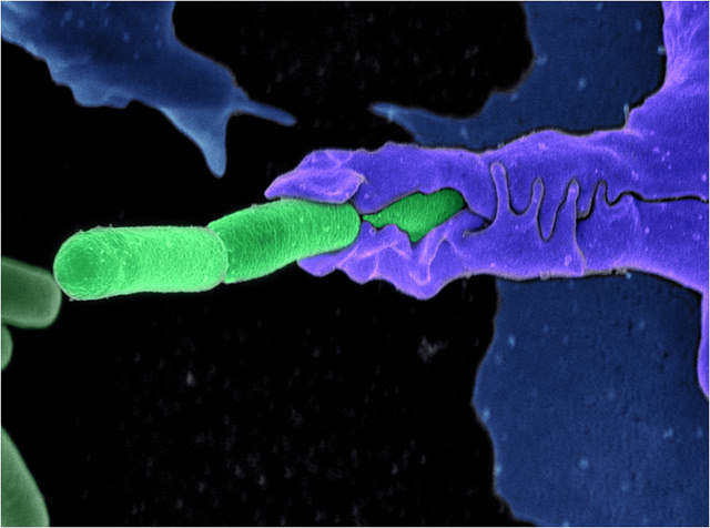 Иммунная клетка поглощает бактерии. (Фото: ZEISS Microscopy / Flickr.com.)