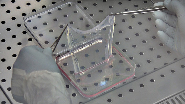 Листок трансгенной кожи, выращенный в лаборатории. (Фото: CMR UNIMORE.)